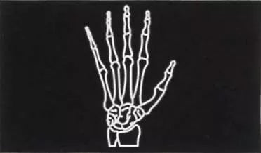 I-Max 3D DVT/OPG mit CEPH