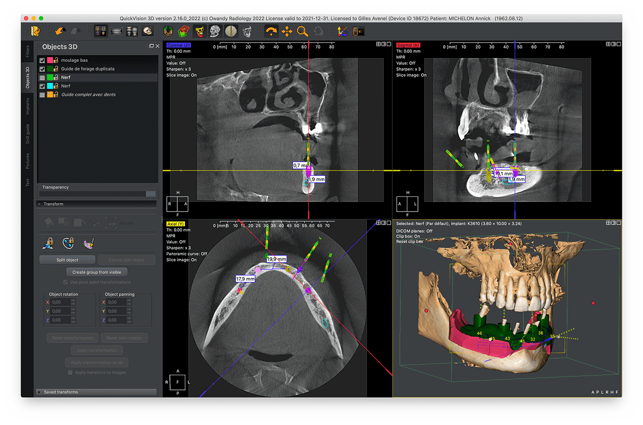 I-Max 3D DVT/OPG mit CEPH